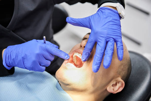 Best Emergency Tooth Extraction in Saco, ME