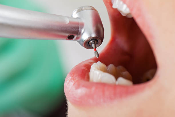 Best Emergency Treatment for Dental Infections or Abscesses in Saco, ME